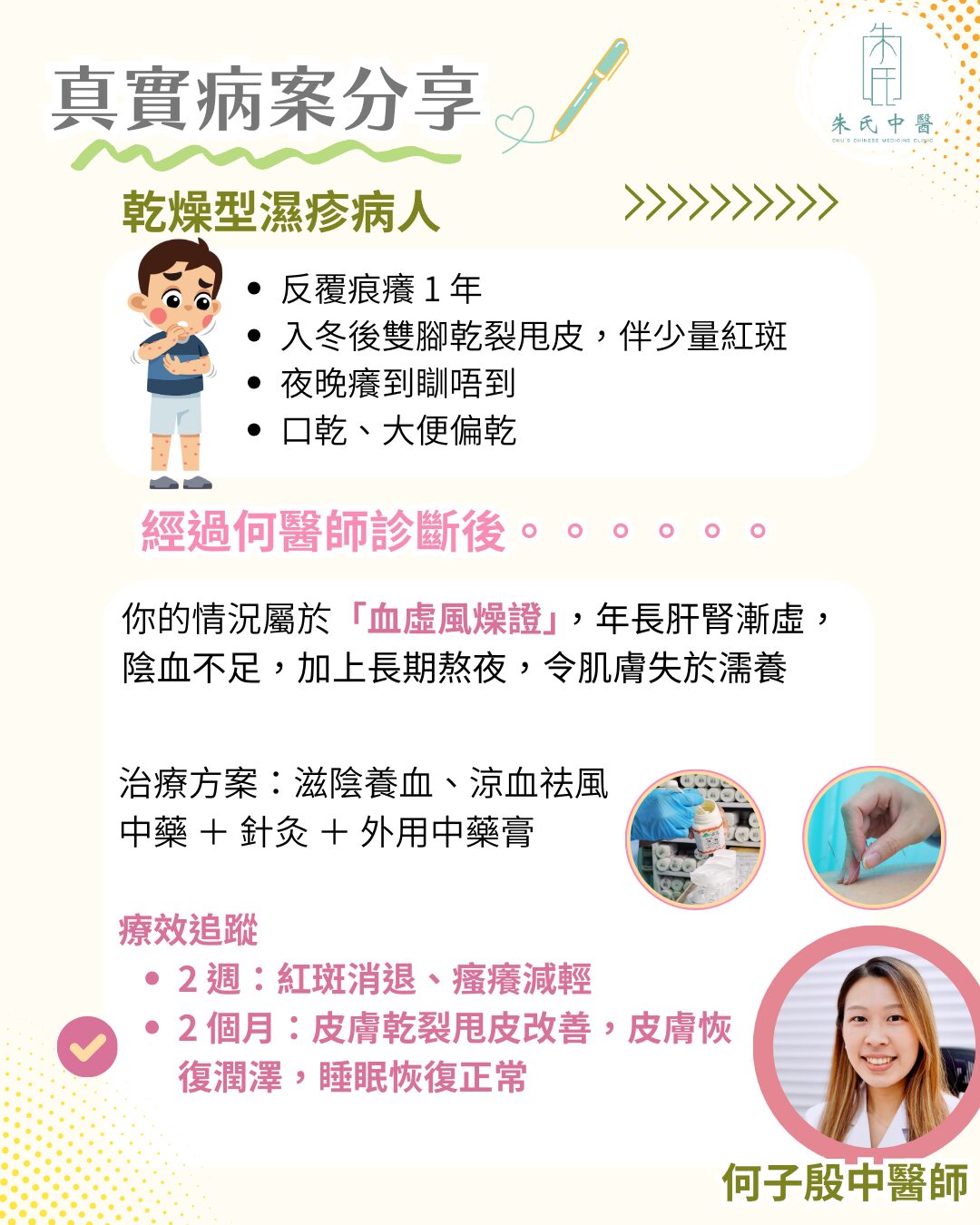病案分享