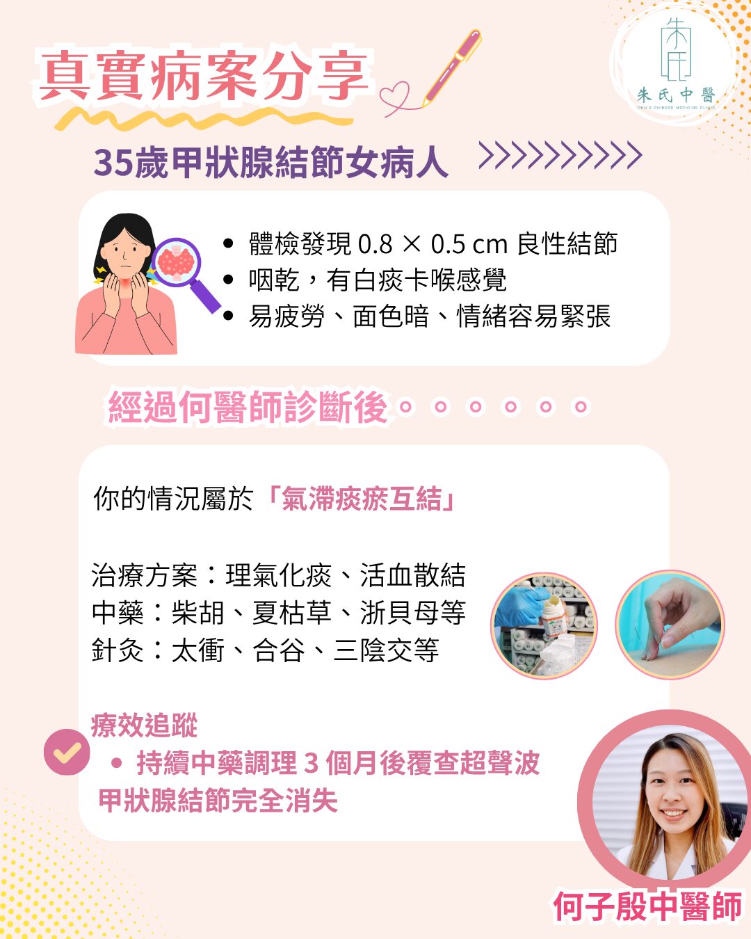 病案分享