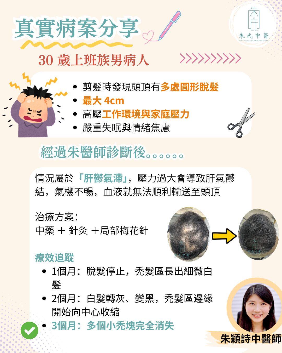 鬼剃頭案例分享對比圖