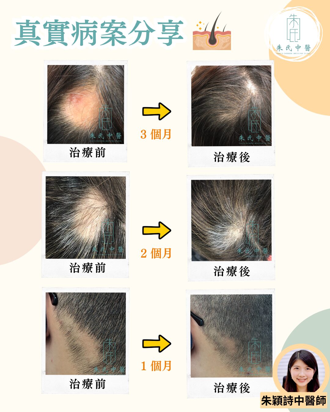 真實病案分享
