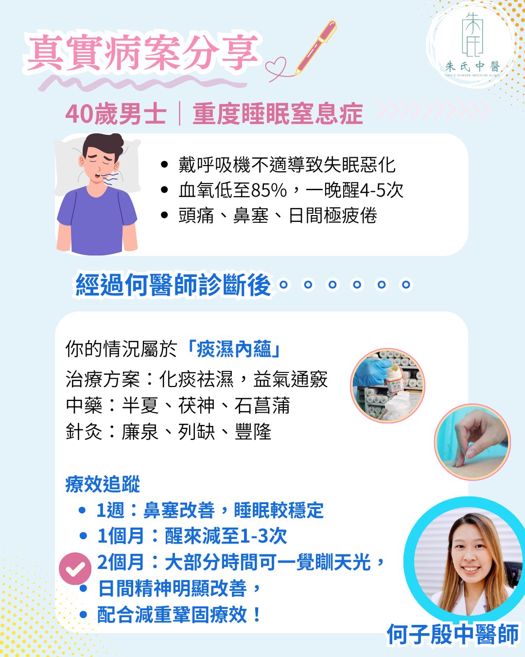 睡眠窒息症病案分享
