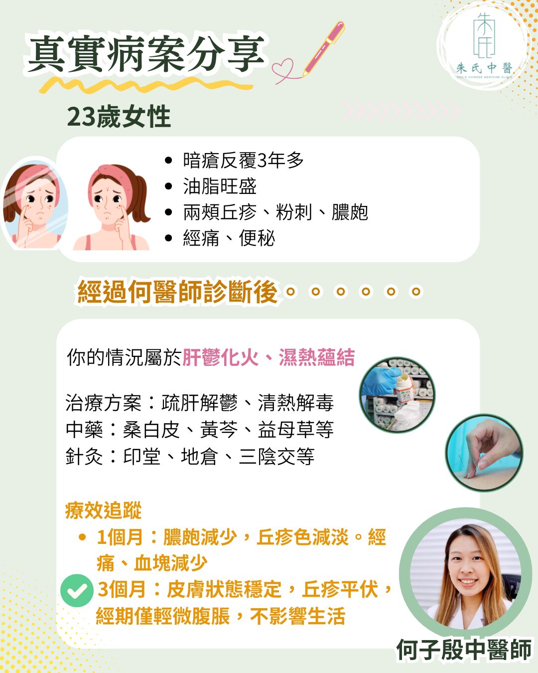 暗瘡治療病案