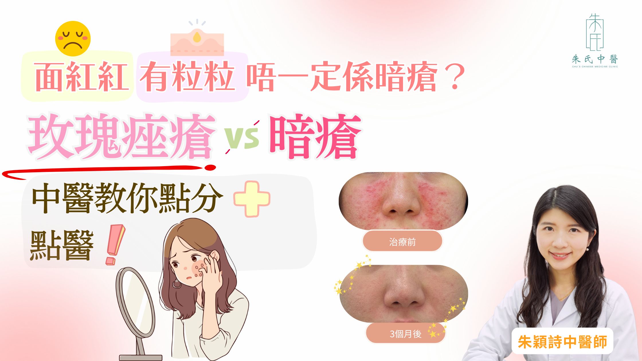 中醫治療玫瑰痤瘡