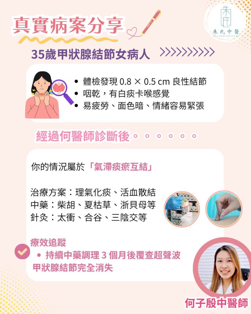 甲狀腺結節病案分享