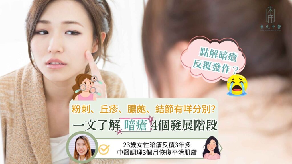 中醫暗瘡