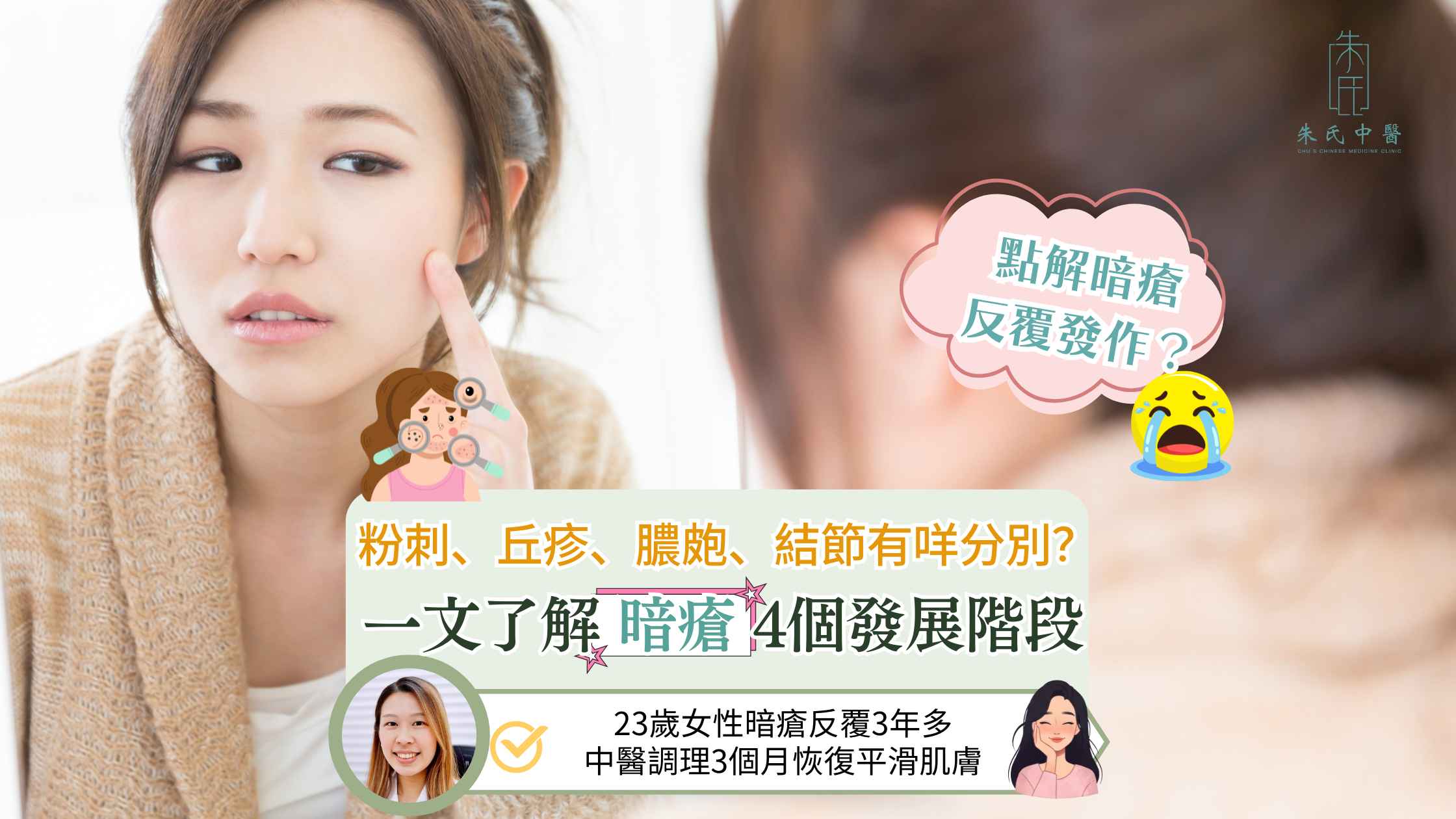 中醫暗瘡
