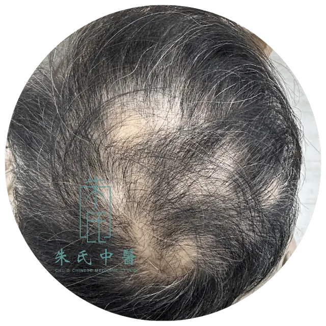 階段 1