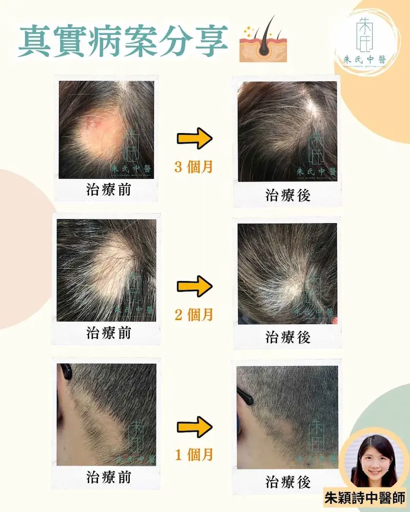 真實病案分享