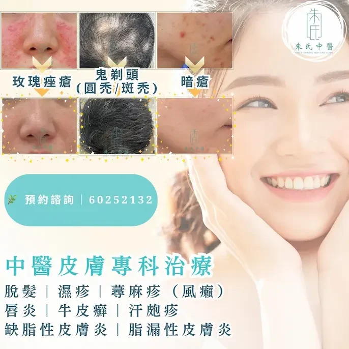 中醫皮膚科專科治療